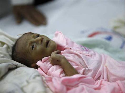 也门战争阴霾下的人道主义崩坏 也门上千万民众饿到无法哭泣-热点新加坡